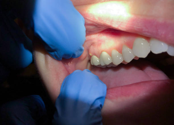 Best Mobile Emergency Dentist in Branchville, SC