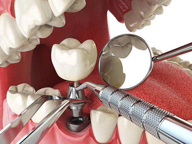 Best Pediatric Emergency Dentist in Branchville, SC